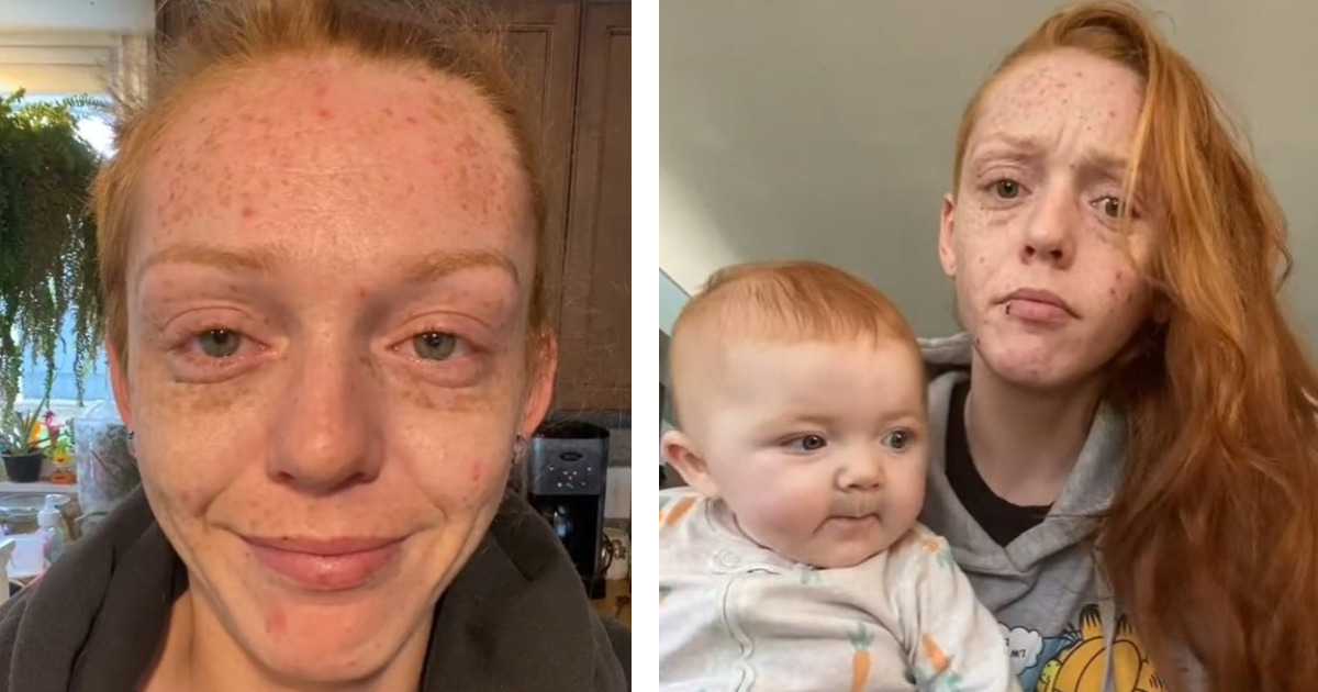 22-latka obwinia córkę za swój wygląd. To ona odebrała mi młodość